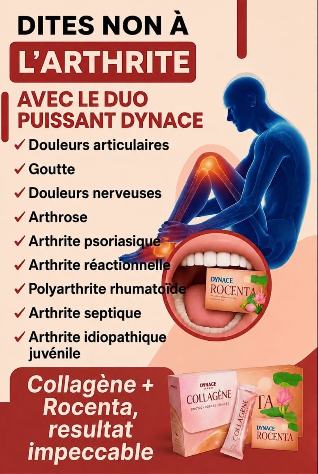 Douleurs articulaires