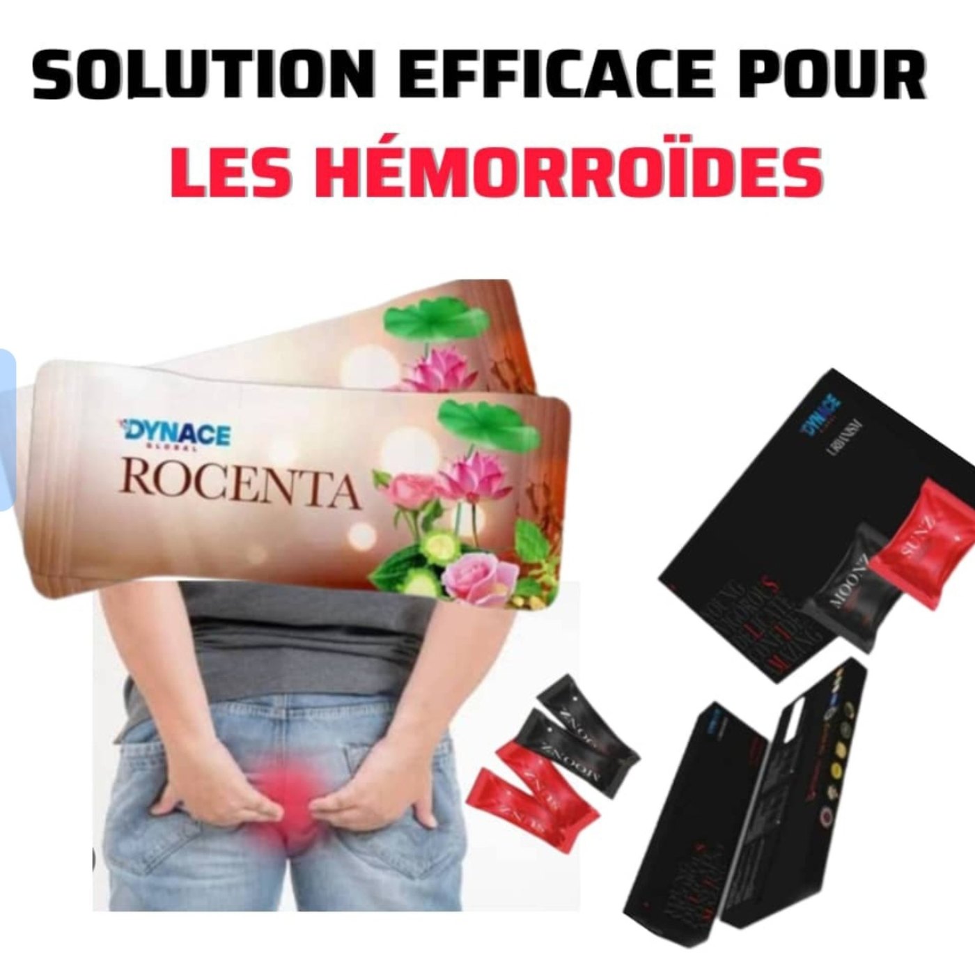 Hémorroïdes